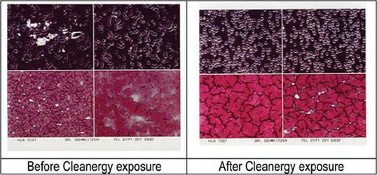 Effetti del Cleanergy sul sangue (2)