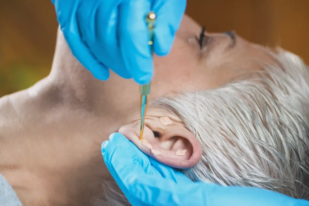 Naturopatia: Agopuntura Cinese, rimedio millenario